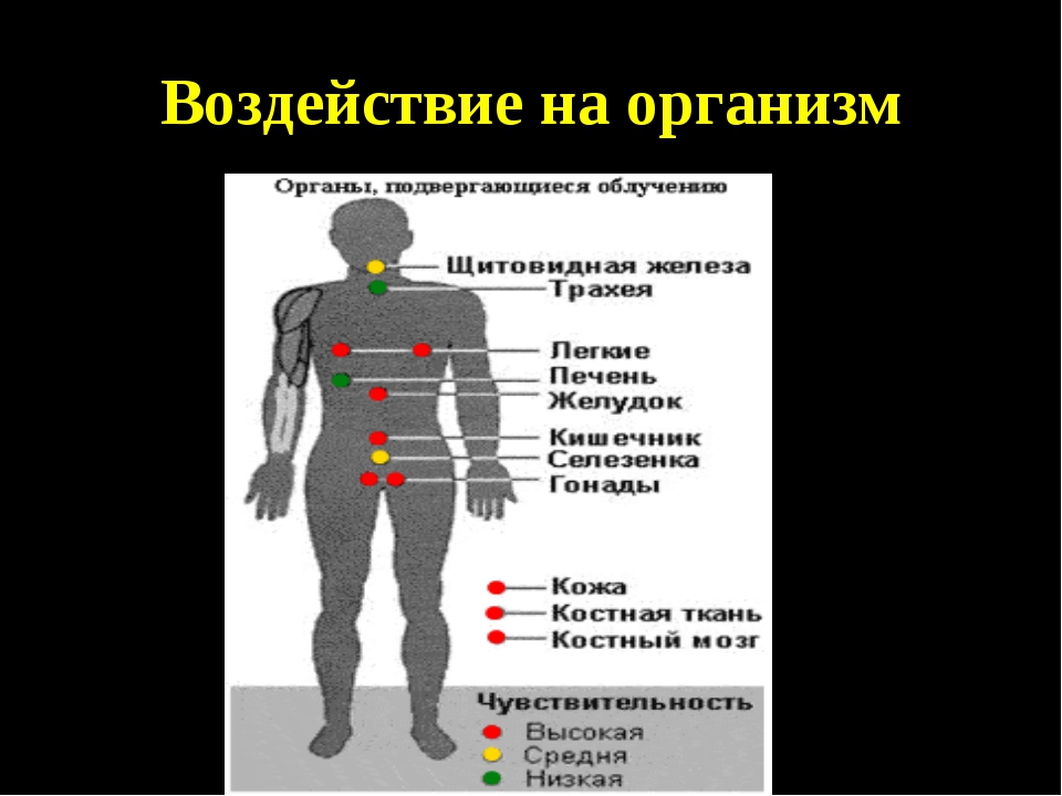 Биологическое действие радиации на человека. Воздействие радиации на человека.