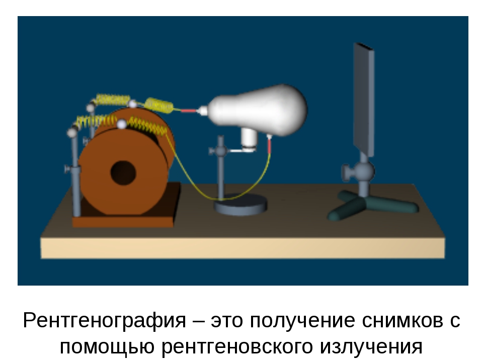 Методика получения рентгеновского изображения