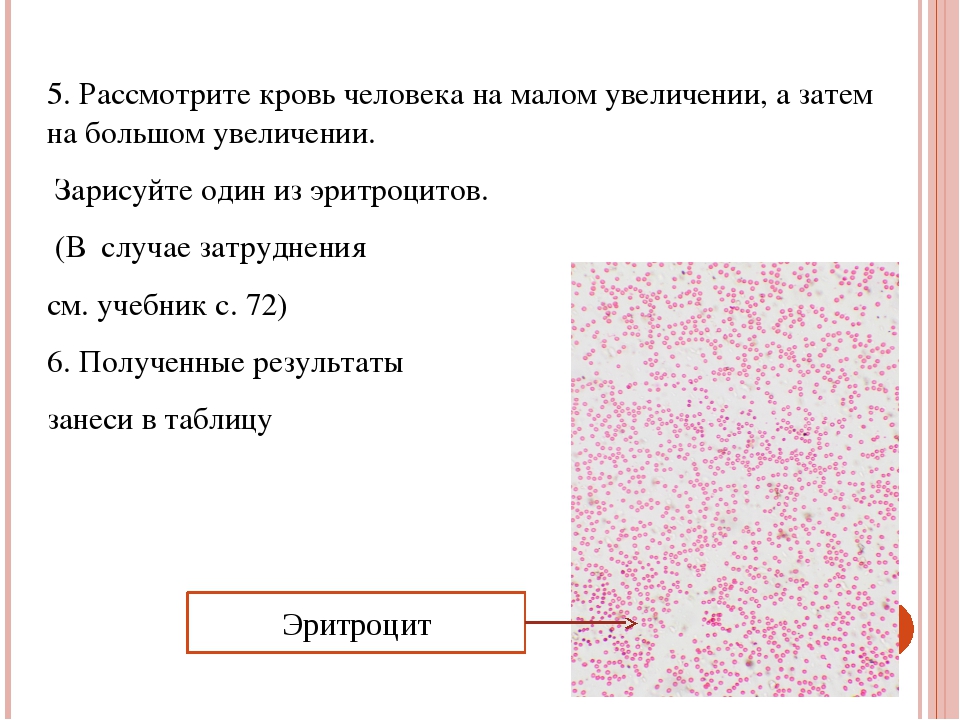 Увеличение рассмотреть. Кровь человека при большом увеличении. Кровь человека при Малом увеличении. Зарисуйте один из эритроцитов человека. Эритроциты человека при Малом увеличении.