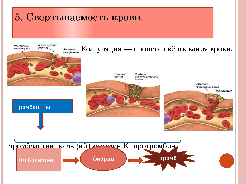 Схема образования фибринового тромба