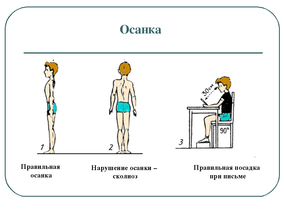 Осанка залог здоровья проект 3 класс