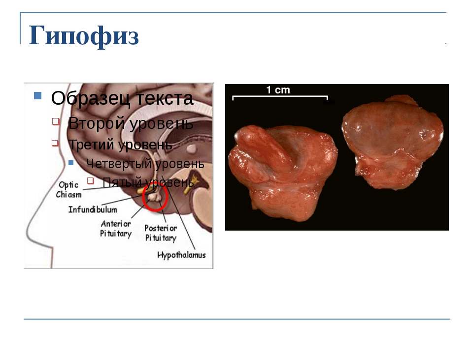 Эндокринные железы презентация