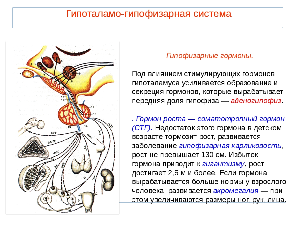 Гипофизарный нанизм презентация