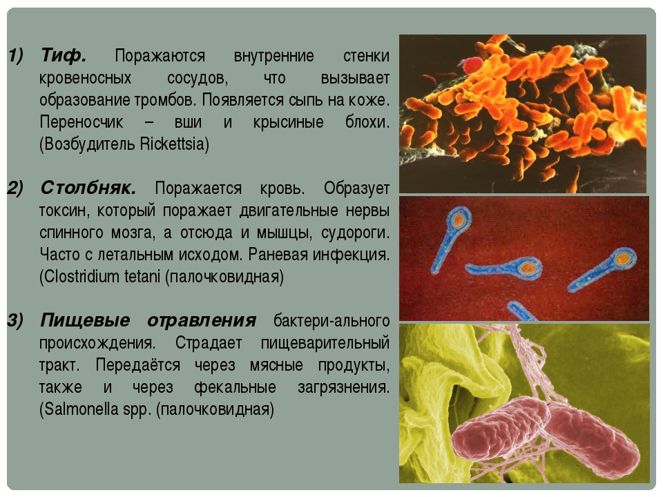 Общая характеристика бактерий 7 класс биология презентация. Бактерии 5 класс биология. Бактерии 7 класс биология. Бактерии презентация 7 класс биология. Примеры бактерий 7 класс.