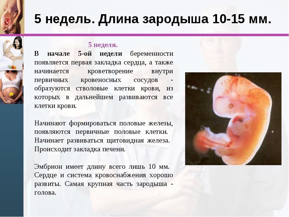 Недельный период. Акушерский срок 5 недель эмбриональный 1 неделя беременности. Эмбрион на 4-5 неделе беременности. Плод на 5 недель 6 дней беременности эмбрион. Размер эмбриона на 5 неделе беременности.
