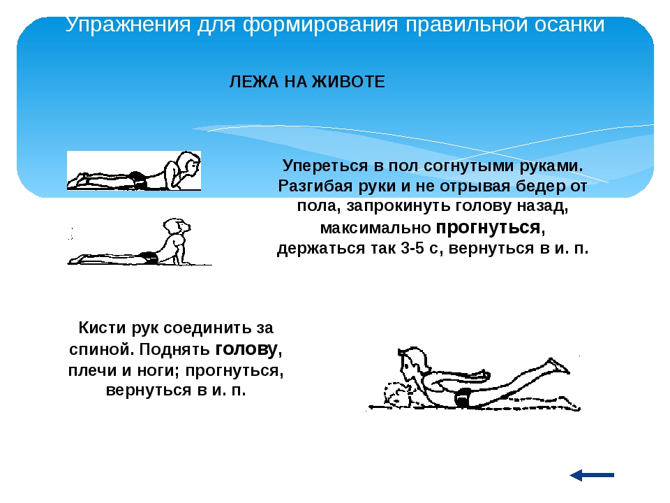 Как называют нарушение осанки изображенное на рисунке 4 назовите одну из причин